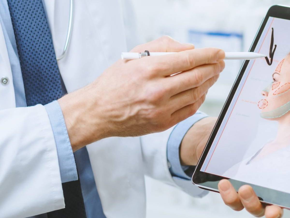 Simulación de rinoplastia