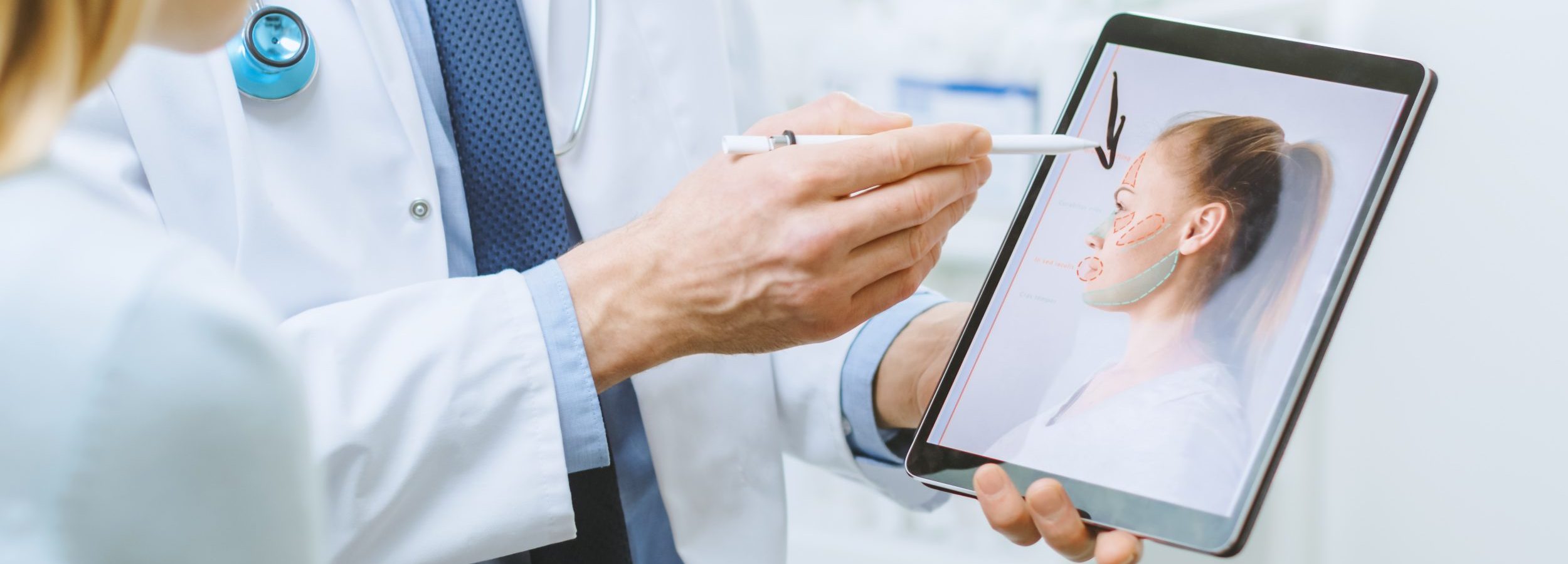 Simulación de rinoplastia