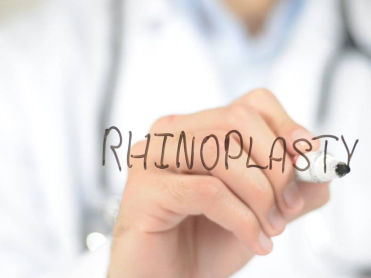 rinoplastia de revisión