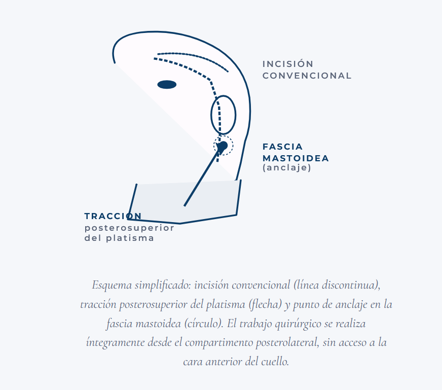 lifting-cervical-posterior